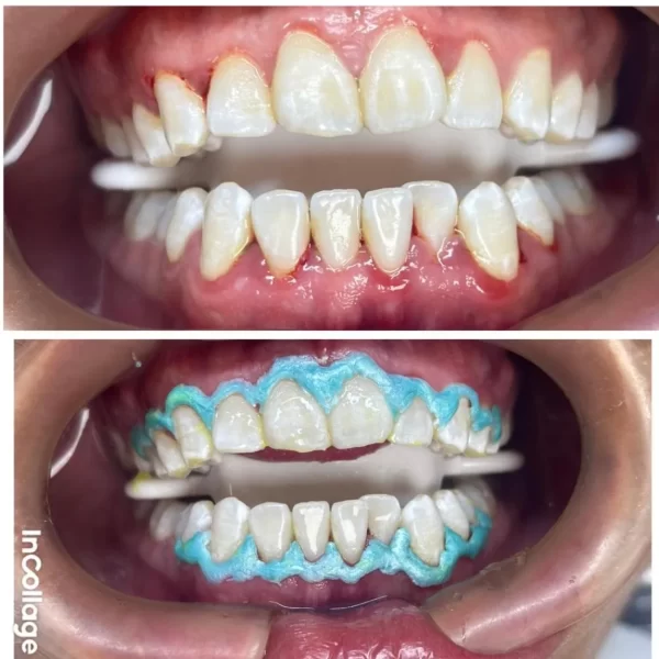 WhatsApp Image 2026-01-13 at 2.18.48 PM-hostros-100